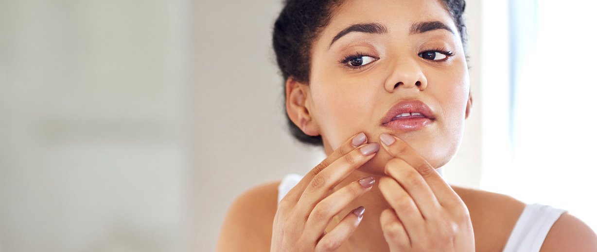 Acne and Acne Scar Treatments