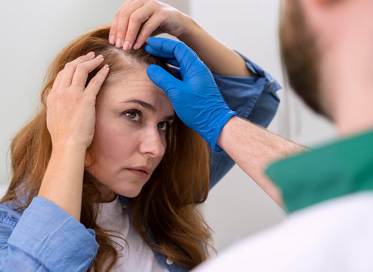 Alopecia Areata Diagnosis and Treatment