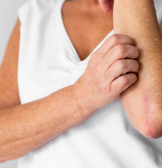 Viral Skin Infection Treatment