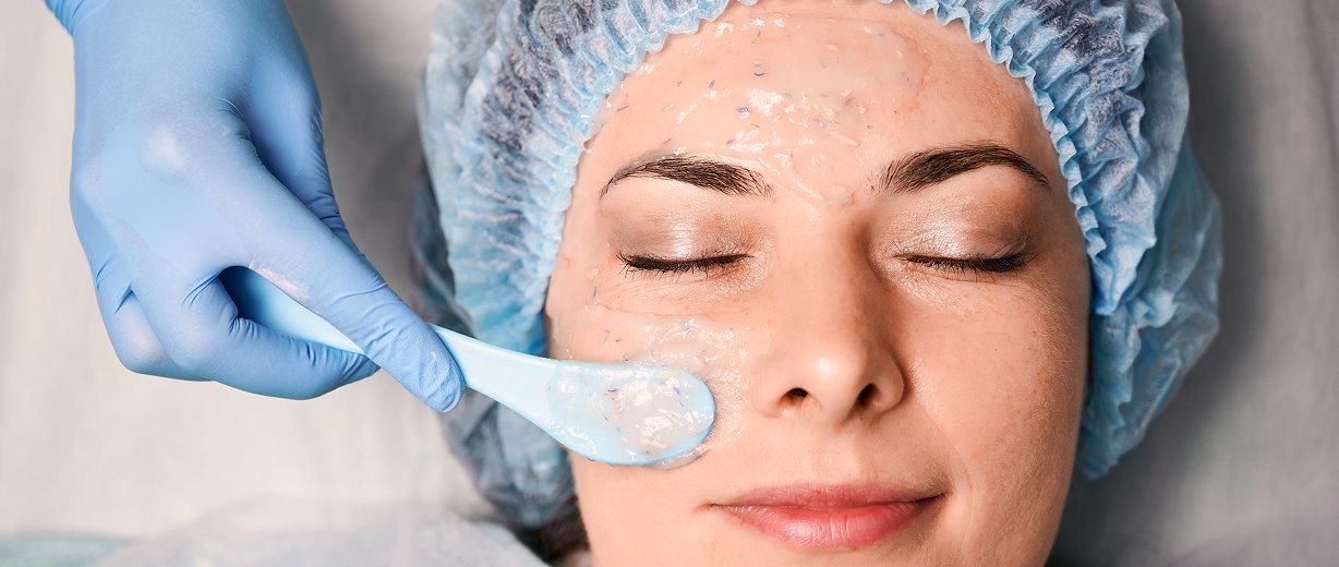 Chemical Peel Treatment