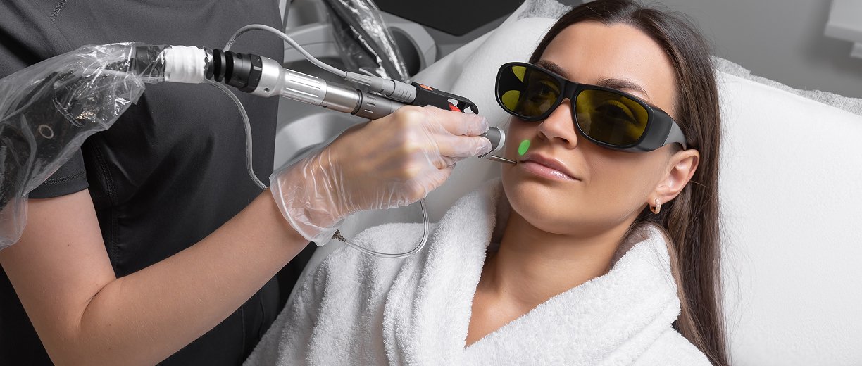CO₂ Laser Treatment