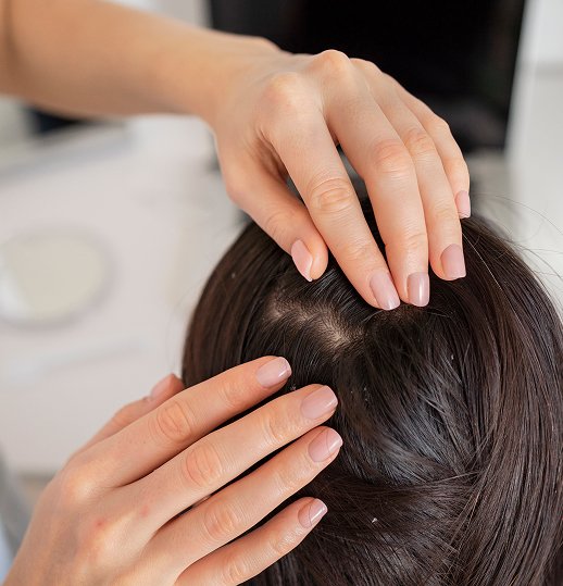 Scalp Disorder Treatment