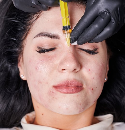 Dermal Filler Treatment Results