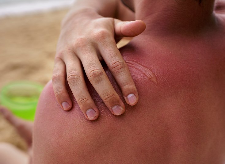 Fungal Skin Infection Treatment