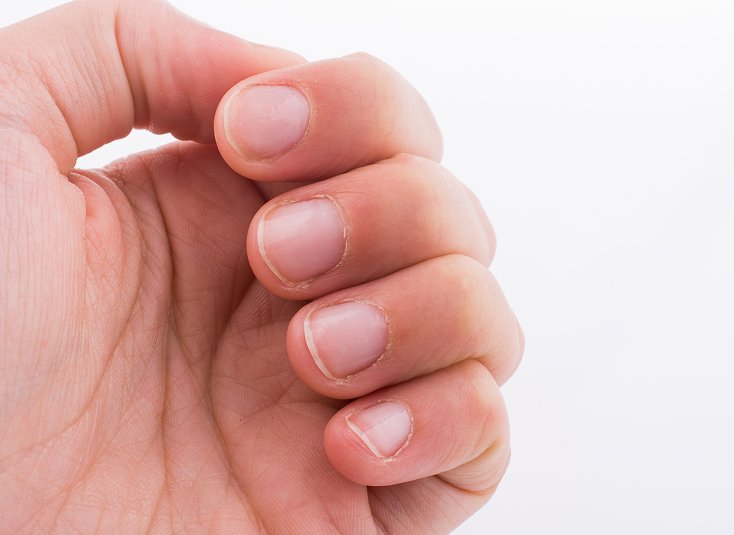 Nail Dystrophy Care