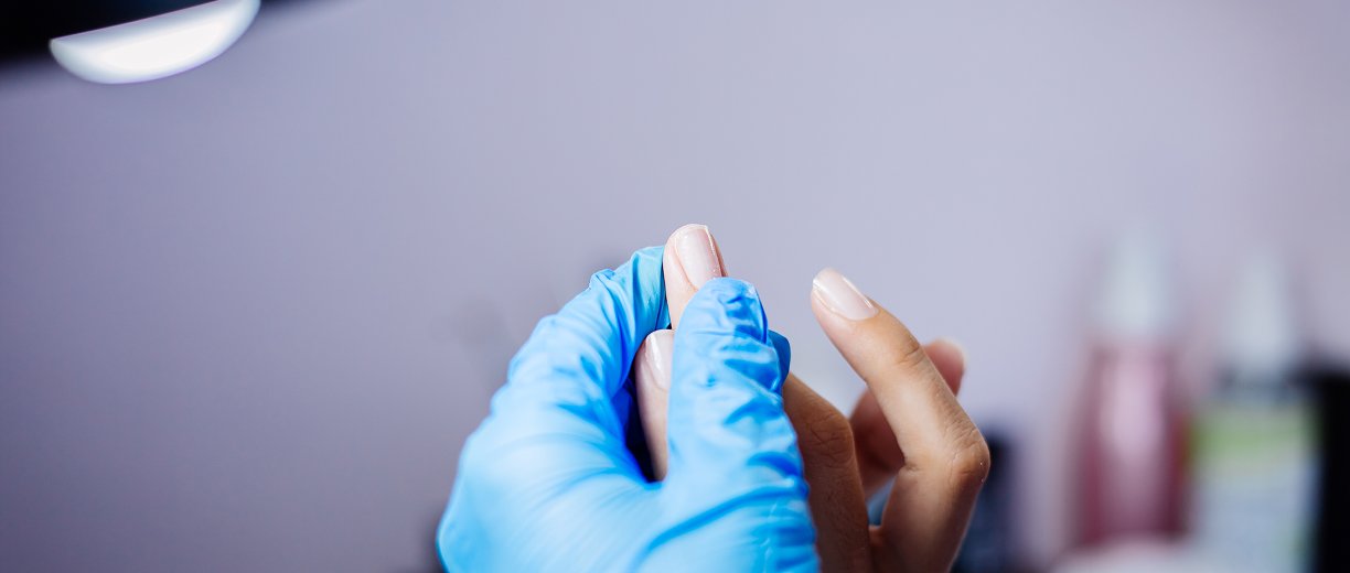 Nail Pigmentation Treatment