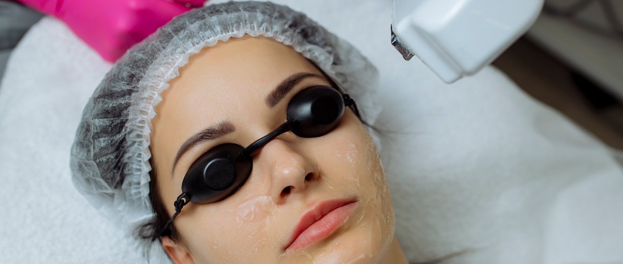 Pigmentation Laser Treatment