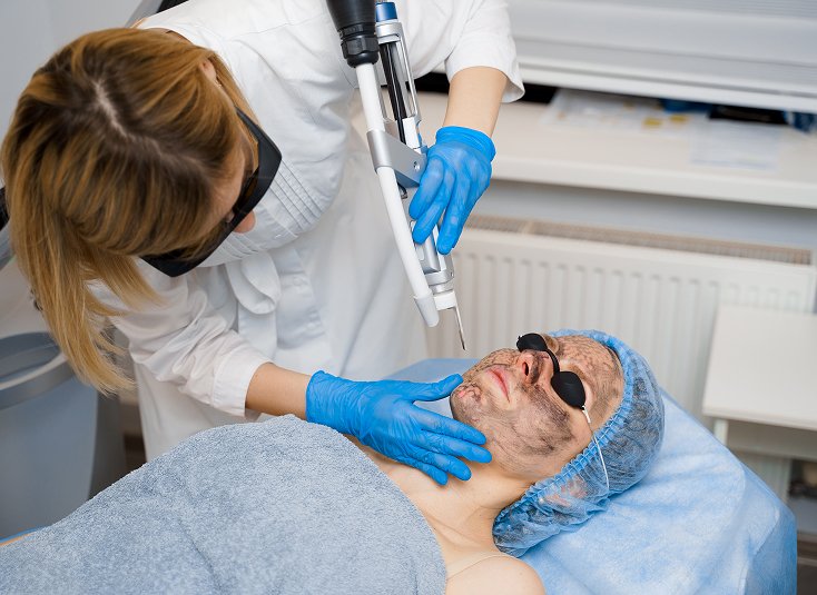 Pigmentation Laser Skin Treatment