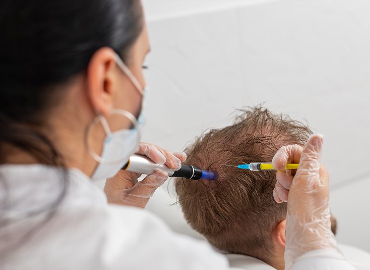 PRP Hair Treatment