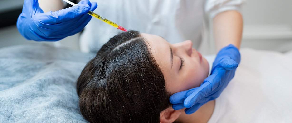 PRP Therapy for Hair Growth