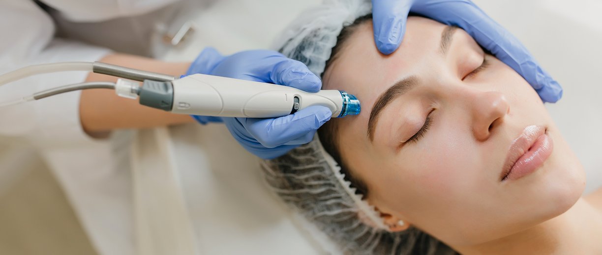 Q-Switched Laser Treatment