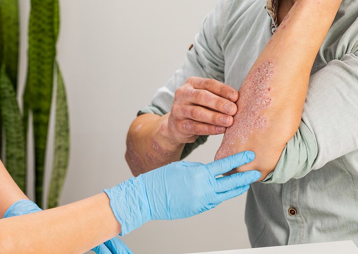 Skin Allergy Diagnosis and Treatment