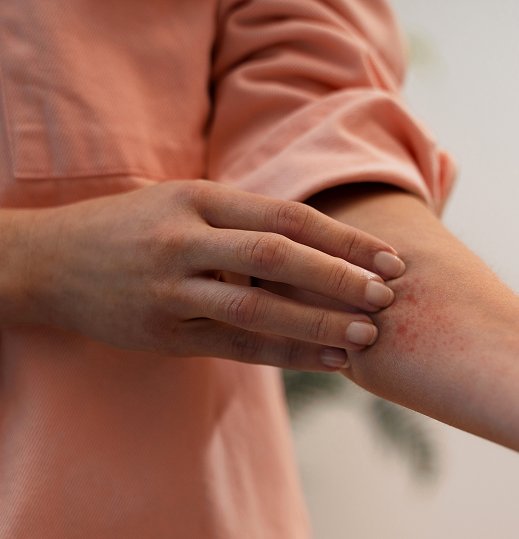 Skin Allergy Care