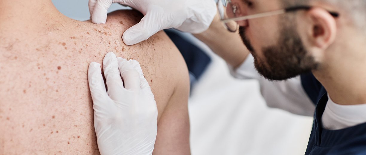 Skin Biopsy Procedure