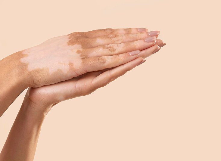 Skin Infection Dermatology Treatment