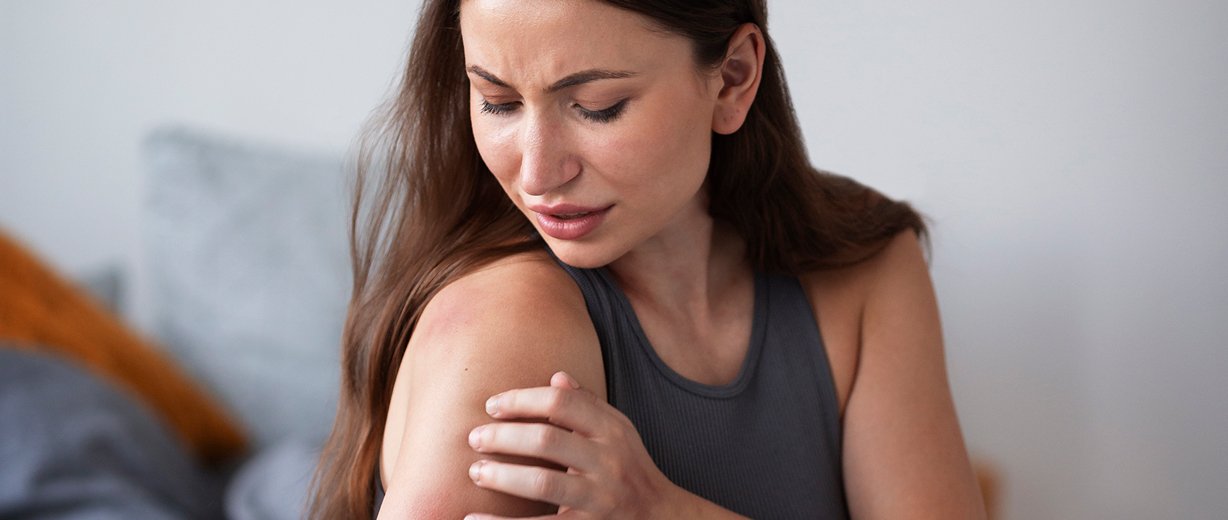 Urticaria and Hives Treatment